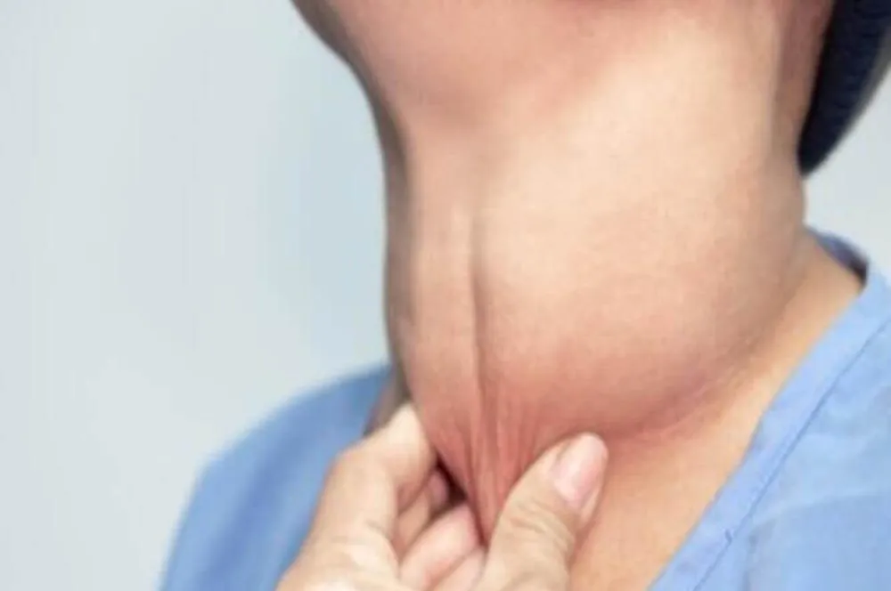 Thyroid Disease