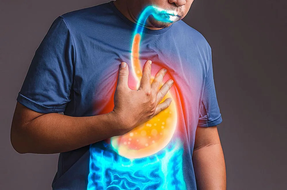 Heartburn/Gastroesophageal Disease