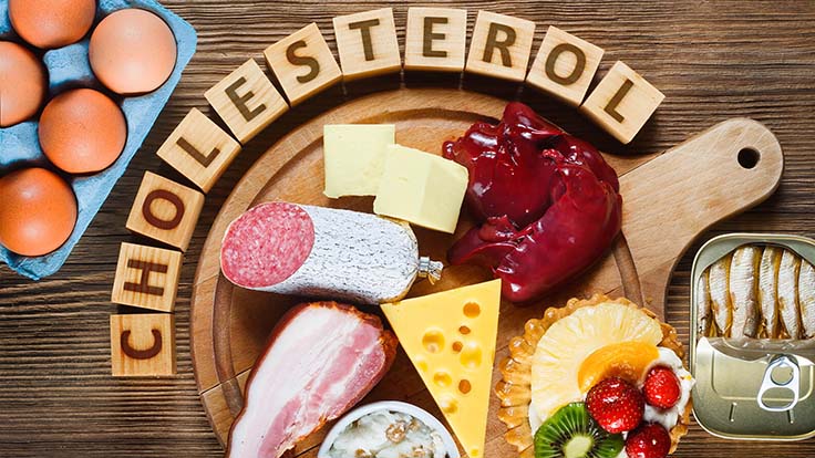 5 High-Cholesterol Foods to Avoid for Healthy Living